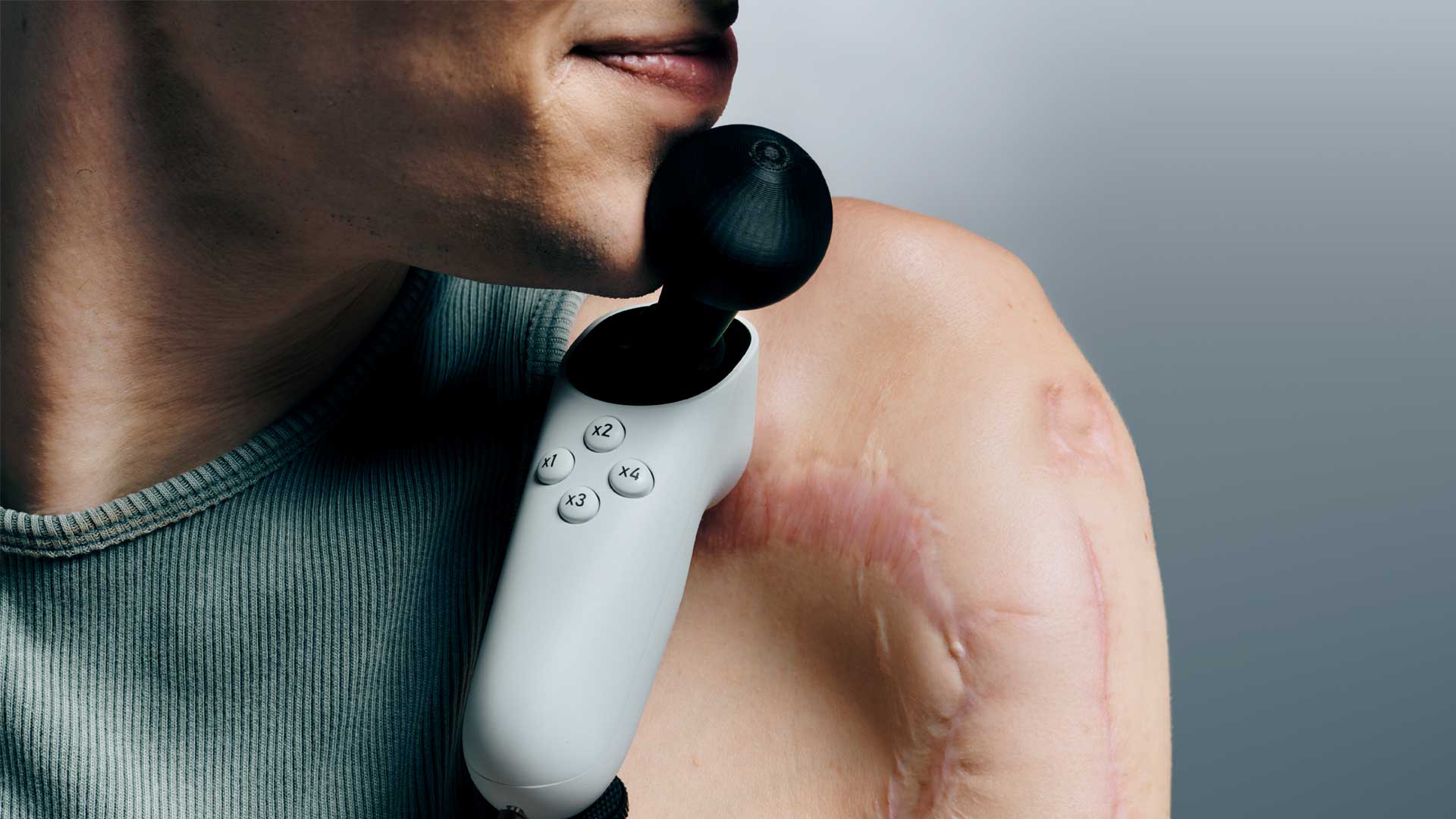 The Xbox Adaptive Joystick